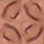 کاشت مژه عابدین