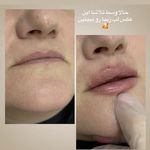 کلینیک زیبایی لاغری لیزر دانا