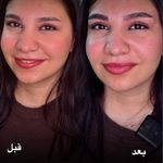 خدمات میکروبلیدینگ و میکروپیگمنتیشن لیا