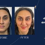 کلینیک زیبایی آرا مهر