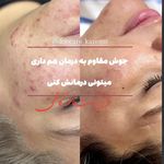 مرکز پوست فاطمه کاظمی - شهرکرد - 5124