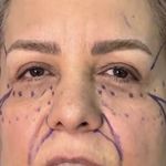 کلینیک زیبایی الماس کاملا اقساطی