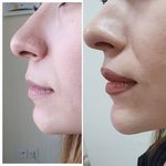 کیلینیک زیبایی الا