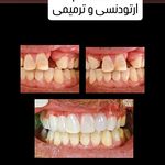 دندانپزسک