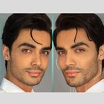 کلینیک پوست و زیبایی ژیلاوَش