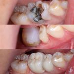 دنداپزشکی دکتر یاشار معزز