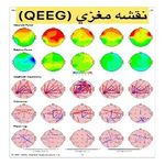 روانشناس و نوروتراپیست فاطمه زارعی