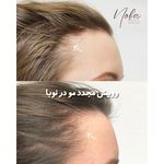 کلینیک زیبایی و لیزر مو زائد نوبا