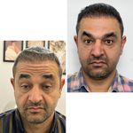 کلینیک زیبایی و جوانسازی پوست و مو الین