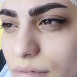 آرایش دائم وریموو تراپی پوست گندم فلاحی