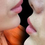 کلینیک زیبایی، پوست و لیزر(کندلا)  ظفر