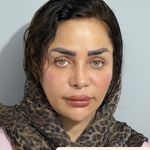 کلینیک زیبایی کاترین