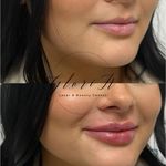 کلینیک زیبایی گلوریا