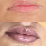 خدمات و آموزش تخصصی پوست و مو لیلاک