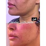 خدمات تخصصی هایفوتراپی شیراز