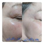 فیشیال و خدمات پوستی برغمدی