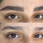 مرکز تخصصی فیبروز ابرو مژگان خناری