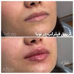 کلینیک زیبایی و لیزر مو زائد نوبا