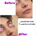 کلینیک پوست و مو و لیزر نیلوفر آبی