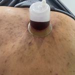کلینیک لیزر و طب سنتی توک