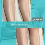 کلینیک تخصصی پوست و زیبایی ملینا