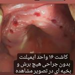 دندانپزشکی ایمپلنت و کلیه خدمات