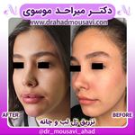دکترمیراحدموسوی