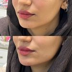 مرکز زیبایی و لیزر دکتر اخوان