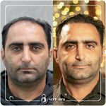 کلینیک پوست مو و زیبایی نوین ایرانا