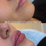 مطب زیبایی آرا
