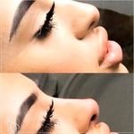 کلینیک پوست و مو و لیزر نیلوفر آبی