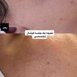 مرکز لیزر ،پوست و زیبایی کندی بیوتی