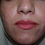 کلینیک زیبایی پوست و مو آتریسا