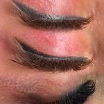 مرکزتخصصی ریموو تتو فریناز کرباسی