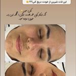 کلینیک فیشال و ماساژ سارن اسکین سارا