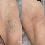 مرکز لیزر و کلینیک زیبایی آروین