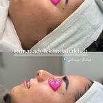 مطب زیبایی آرا