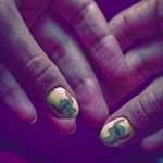 کاشت ناخن لوتوس