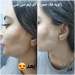 کلینیک زیبایی و لیزر مو گندم شرق تهران