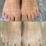 فیشال وپاکسازی تخصصی صورت و بدن اصفهان