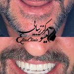 کلینیک دندان پزشکی و ایمپلنت الیسو