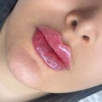 کلینیک لیزر و زیبایی نیلوفر