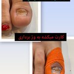 پدیکور و پدولوژیست فرزانه محمدی