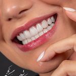 کلینیک دندانپزشکی تیدنتا