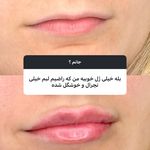 کلینیک تخصصی پوست و زیبایی ملینا