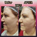 مطب پوست ،مو و لیزر یسنا طب