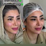 کلینیک زیبایی و لیزر دکتر آزاده اسماعیلی
