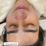 خدمات فیشیال و پاکسازی پوست