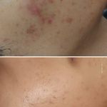 فیشال و پاکسازی شیرین نصیری درمالند