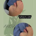 کلینیک زیبایی لاغری لیزر دانا